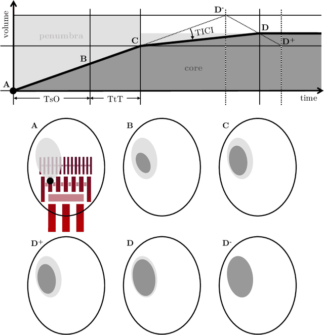 Figure 3 for Final infarct prediction in acute ischemic stroke
