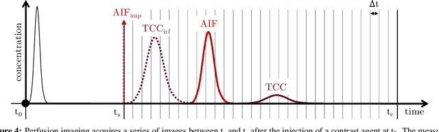 Figure 4 for Final infarct prediction in acute ischemic stroke