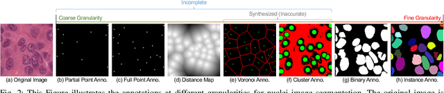 Figure 3 for BoNuS: Boundary Mining for Nuclei Segmentation with Partial Point Labels