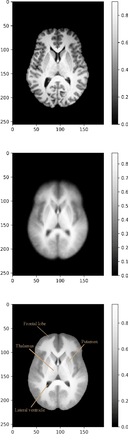 Figure 2 for Quantifying the Resolution of a Template after Image Registration