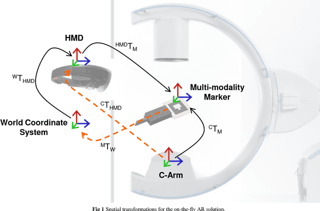 Figure 1 for On-the-fly Augmented Reality for Orthopaedic Surgery Using a Multi-Modal Fiducial