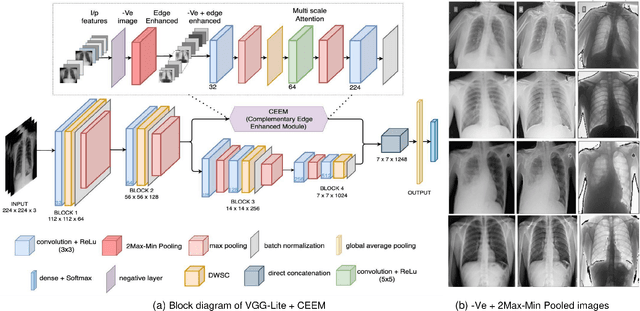 Figure 2 for Novel Pooling-based VGG-Lite for Pneumonia and Covid-19 Detection from Imbalanced Chest X-Ray Datasets