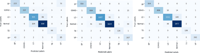Figure 4 for Novel Pooling-based VGG-Lite for Pneumonia and Covid-19 Detection from Imbalanced Chest X-Ray Datasets