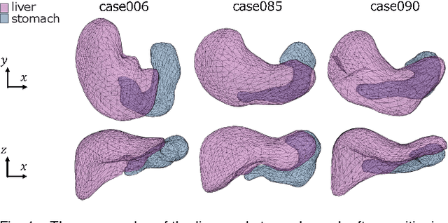 Figure 1 for Construction of an Organ Shape Atlas Using a Hierarchical Mesh Variational Autoencoder