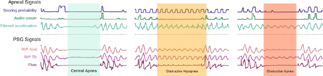 Figure 3 for Validation of a new, minimally-invasive, software smartphone device to predict sleep apnea and its severity: transversal study