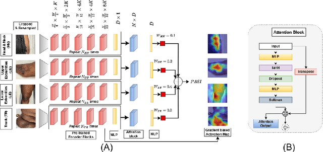 Figure 1 for PSO-Net: Development of an automated psoriasis assessment system using attention-based interpretable deep neural networks
