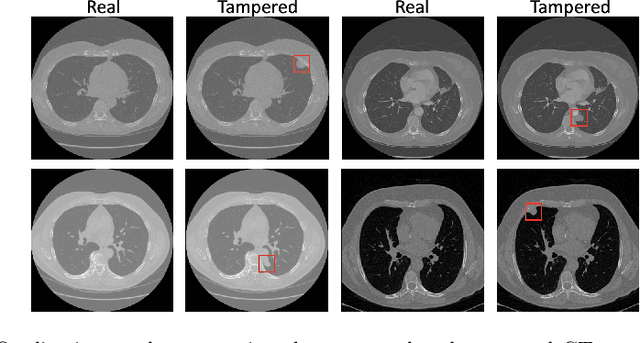 Figure 3 for MITS-GAN: Safeguarding Medical Imaging from Tampering with Generative Adversarial Networks
