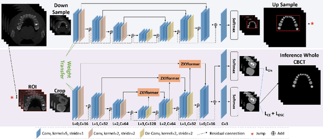 Figure 1 for Teeth And Root Canals Segmentation Using ZXYFormer With Uncertainty Guidance And Weight Transfer