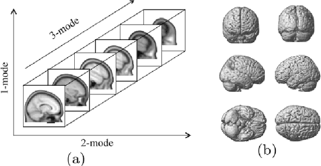 Figure 1 for Structure-Preserving Margin Distribution Learning for High-Order Tensor Data with Low-Rank Decomposition
