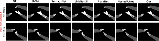 Figure 4 for SEGSRNet for Stereo-Endoscopic Image Super-Resolution and Surgical Instrument Segmentation