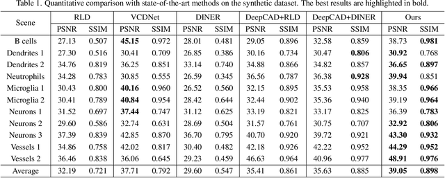 Figure 2 for V2V3D: View-to-View Denoised 3D Reconstruction for Light-Field Microscopy