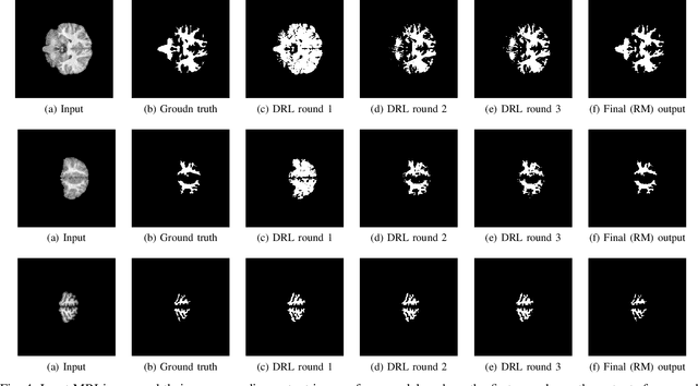 Figure 4 for Cloud-based Federated Learning Framework for MRI Segmentation