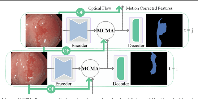 Figure 1 for Motion-Corrected Moving Average: Including Post-Hoc Temporal Information for Improved Video Segmentation