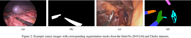 Figure 3 for Motion-Corrected Moving Average: Including Post-Hoc Temporal Information for Improved Video Segmentation