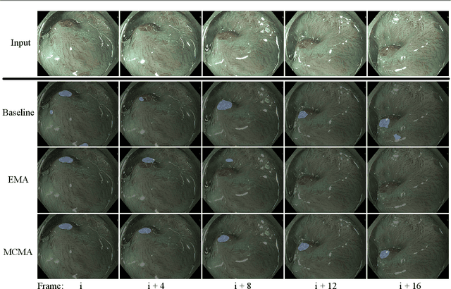 Figure 4 for Motion-Corrected Moving Average: Including Post-Hoc Temporal Information for Improved Video Segmentation