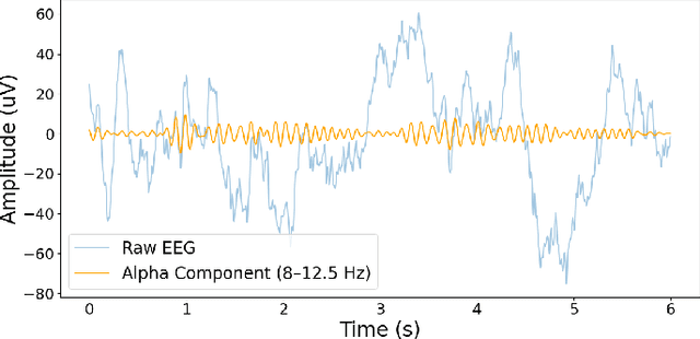 Figure 2 for Enhancing Alzheimer's Detection through Late Fusion of Multi-Modal EEG Features