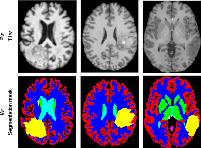 Figure 4 for Learning to segment anatomy and lesions from disparately labeled sources in brain MRI