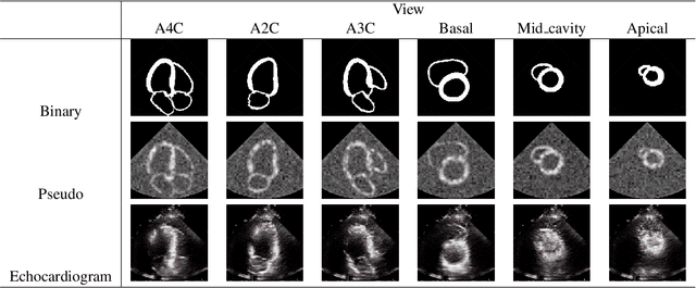Figure 4 for S2MNet: Speckle-To-Mesh Net for Three-Dimensional Cardiac Morphology Reconstruction via Echocardiogram