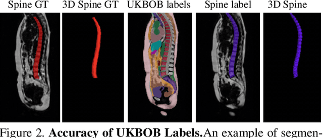 Figure 4 for UKBOB: One Billion MRI Labeled Masks for Generalizable 3D Medical Image Segmentation