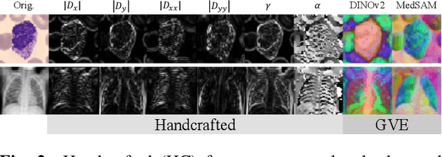 Figure 3 for Covariance Descriptors Meet General Vision Encoders: Riemannian Deep Learning for Medical Image Classification