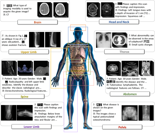 Figure 3 for Towards Generalist Foundation Model for Radiology
