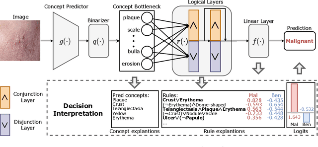 Figure 1 for Learning Concept-Driven Logical Rules for Interpretable and Generalizable Medical Image Classification