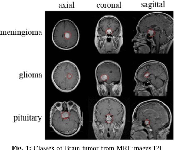 Figure 1 for Deep Brain Net: An Optimized Deep Learning Model for Brain tumor Detection in MRI Images Using EfficientNetB0 and ResNet50 with Transfer Learning