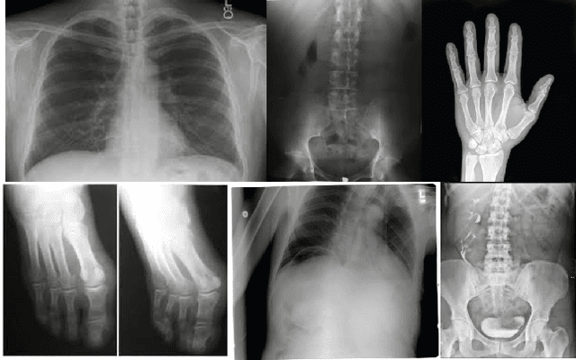 Figure 1 for U-Net in Medical Image Segmentation: A Review of Its Applications Across Modalities