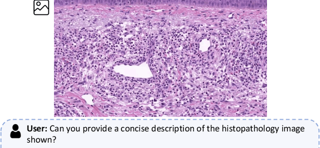 Figure 1 for Quilt-LLaVA: Visual Instruction Tuning by Extracting Localized Narratives from Open-Source Histopathology Videos
