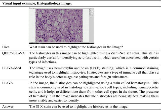Figure 4 for Quilt-LLaVA: Visual Instruction Tuning by Extracting Localized Narratives from Open-Source Histopathology Videos