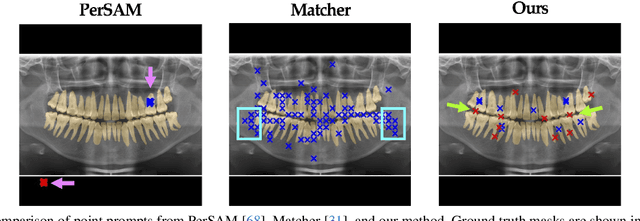Figure 1 for Med-PerSAM: One-Shot Visual Prompt Tuning for Personalized Segment Anything Model in Medical Domain