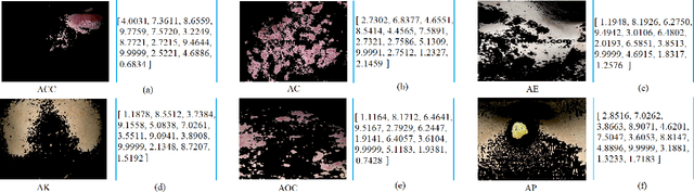 Figure 3 for In-Depth Analysis of Automated Acne Disease Recognition and Classification