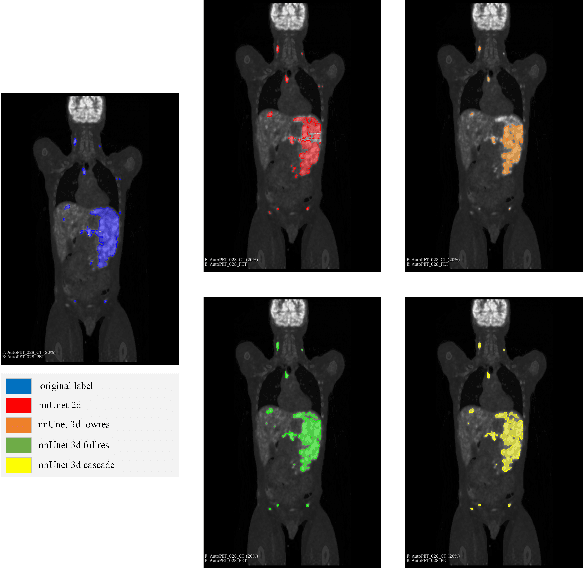 Figure 4 for Deep Learning-Based Segmentation of Tumors in PET/CT Volumes: Benchmark of Different Architectures and Training Strategies
