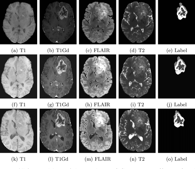 Figure 3 for How we won BraTS 2023 Adult Glioma challenge? Just faking it! Enhanced Synthetic Data Augmentation and Model Ensemble for brain tumour segmentation