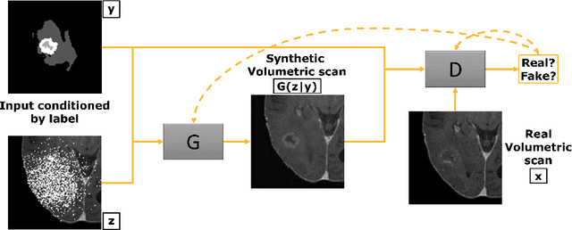Figure 4 for How we won BraTS 2023 Adult Glioma challenge? Just faking it! Enhanced Synthetic Data Augmentation and Model Ensemble for brain tumour segmentation