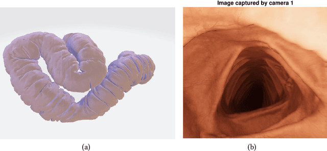 Figure 1 for 3D Reconstruction of the Human Colon from Capsule Endoscope Video