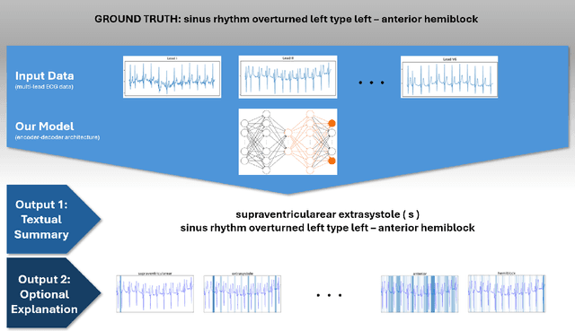 Figure 1 for Automated Medical Report Generation for ECG Data: Bridging Medical Text and Signal Processing with Deep Learning