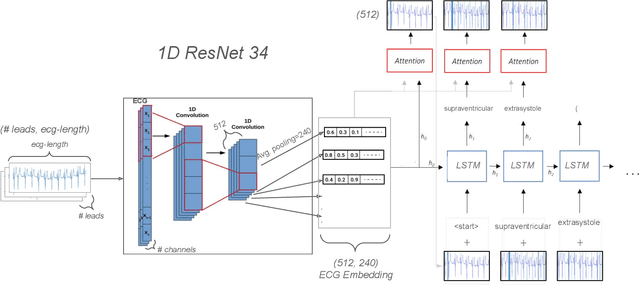 Figure 2 for Automated Medical Report Generation for ECG Data: Bridging Medical Text and Signal Processing with Deep Learning