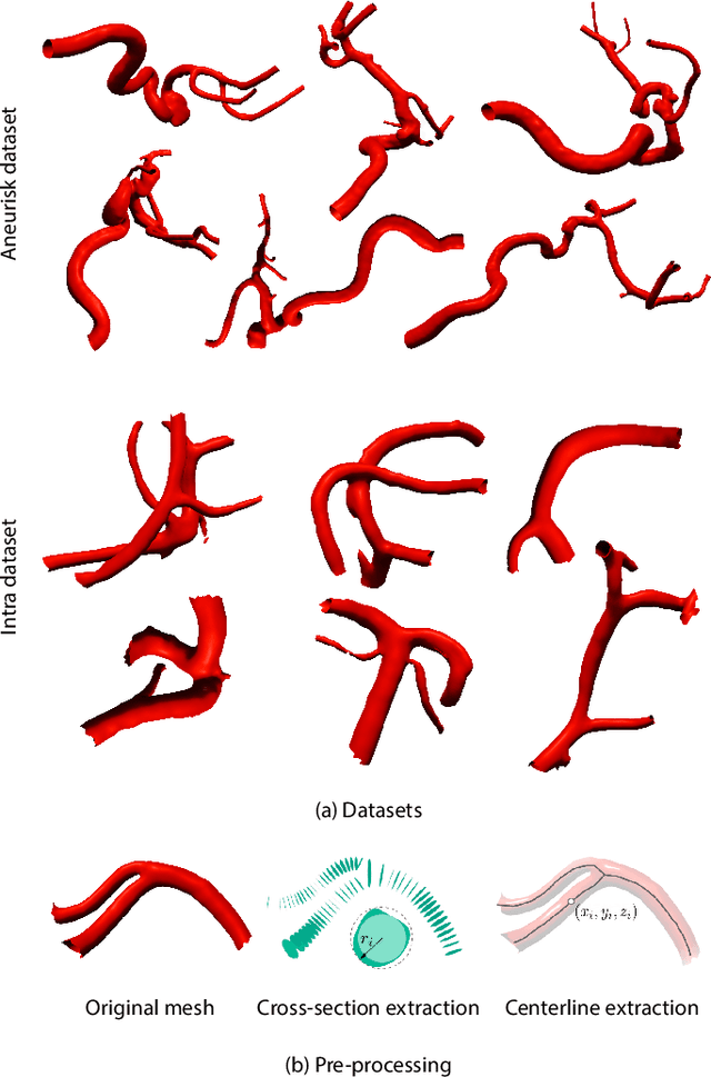 Figure 1 for Recursive Variational Autoencoders for 3D Blood Vessel Generative Modeling