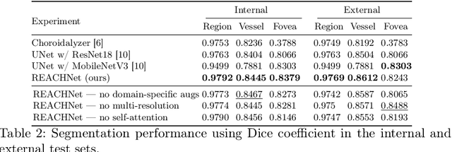 Figure 3 for Domain-specific augmentations with resolution agnostic self-attention mechanism improves choroid segmentation in optical coherence tomography images