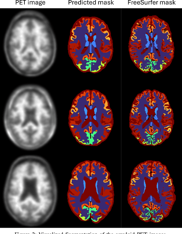 Figure 2 for A Segmentation Framework for Accurate Diagnosis of Amyloid Positivity without Structural Images