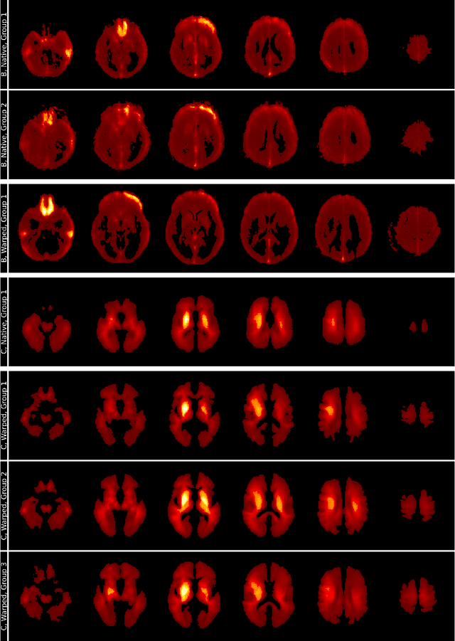 Figure 2 for Identifying Alzheimer's Disease Prediction Strategies of Convolutional Neural Network Classifiers using R2* Maps and Spectral Clustering