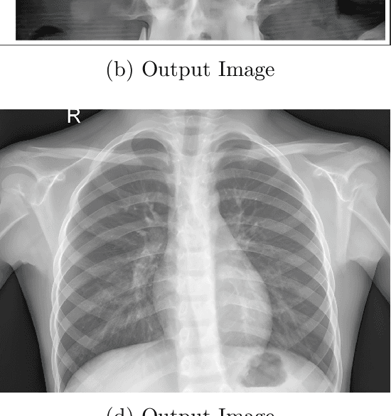 Figure 3 for Efficient Medicinal Image Transmission and Resolution Enhancement via GAN