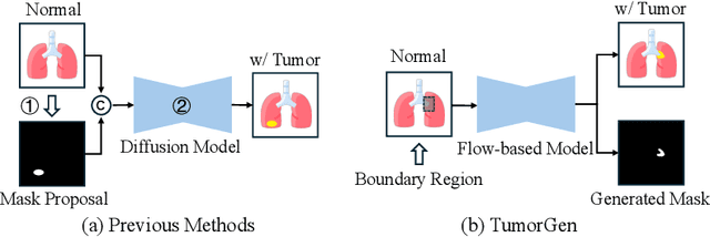Figure 1 for TumorGen: Boundary-Aware Tumor-Mask Synthesis with Rectified Flow Matching