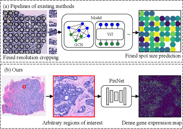 Figure 1 for Spatial Transcriptomics Analysis of Spatially Dense Gene Expression Prediction