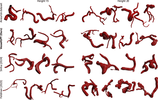 Figure 3 for VesselGPT: Autoregressive Modeling of Vascular Geometry