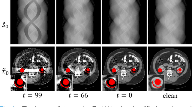 Figure 2 for Unsupervised CT Metal Artifact Reduction by Plugging Diffusion Priors in Dual Domains