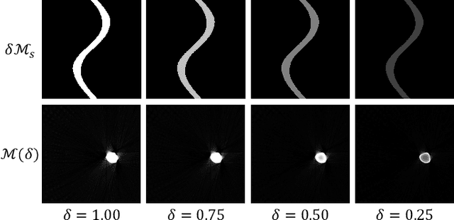 Figure 3 for Unsupervised CT Metal Artifact Reduction by Plugging Diffusion Priors in Dual Domains