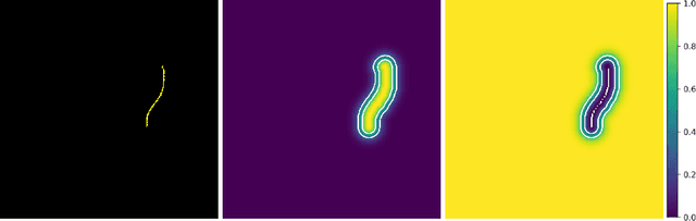 Figure 4 for From Sparse to Precise: A Practical Editing Approach for Intracardiac Echocardiography Segmentation
