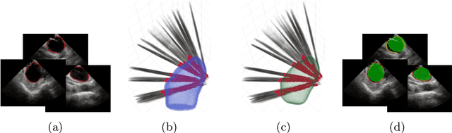 Figure 1 for From Sparse to Precise: A Practical Editing Approach for Intracardiac Echocardiography Segmentation